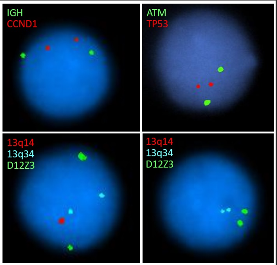 CLL FISH panel; IGH CCND1